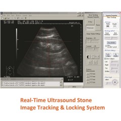 Extracorporeal Shock Wave Lithotripter (ESWL) / 3