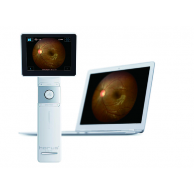 Horus+Digital Fundus Camera_DEC 200